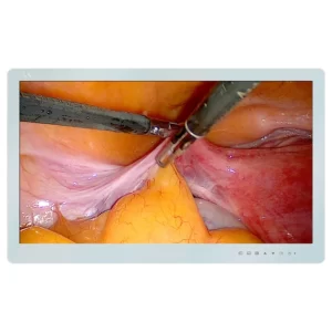 Medical Grade Monitor